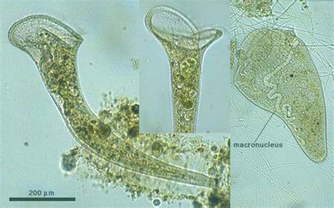  Siderastrum! A Single-Celled Superstar That Makes You Appreciate Microscopic Diversity